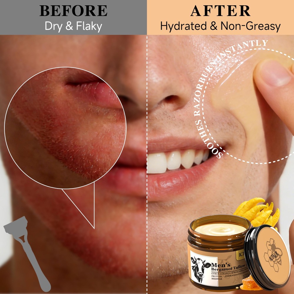 Grass-Fed Beef Tallow Balm for Men - Whipped Face Moisturizer...