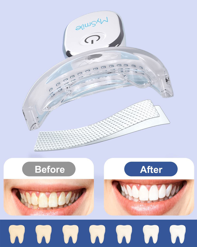 MySmile 28-LED Teeth Whitening Accelerator Light, Rechargeable