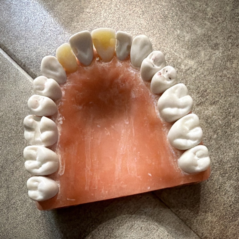 Dental Typodont Model Removable Teeth Full Set Upper/Lower Jaw for Dentistry
