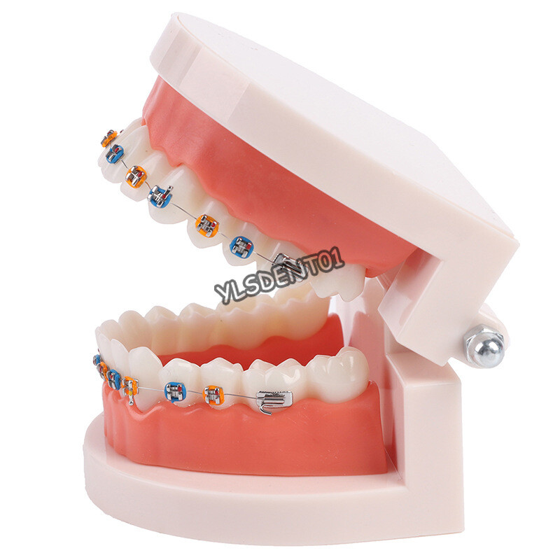 Dental Typodont Orthodontic Treatment Teeth Model Malocclusion Study w/ Bracket