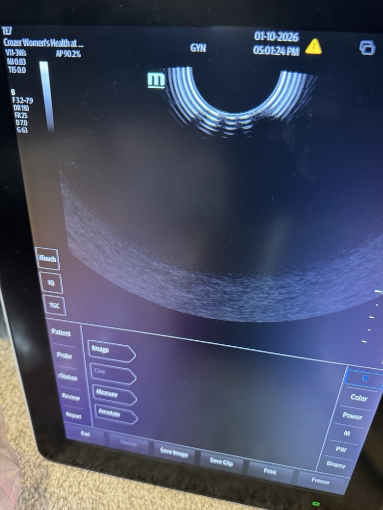 Mindray V11-3WS Endovaginal Ultrasound Probe