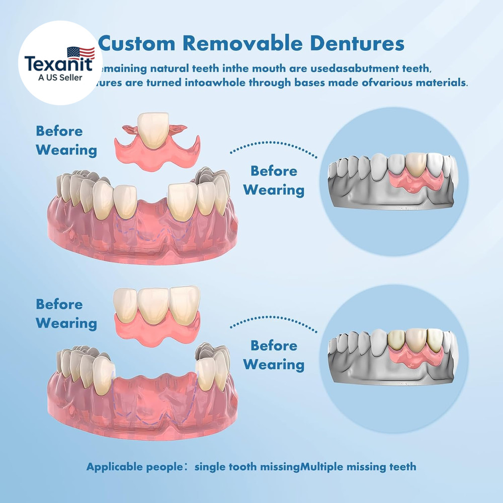 Custom Removable Dentures – Personalized Partial Denture Set for Tooth Replaceme