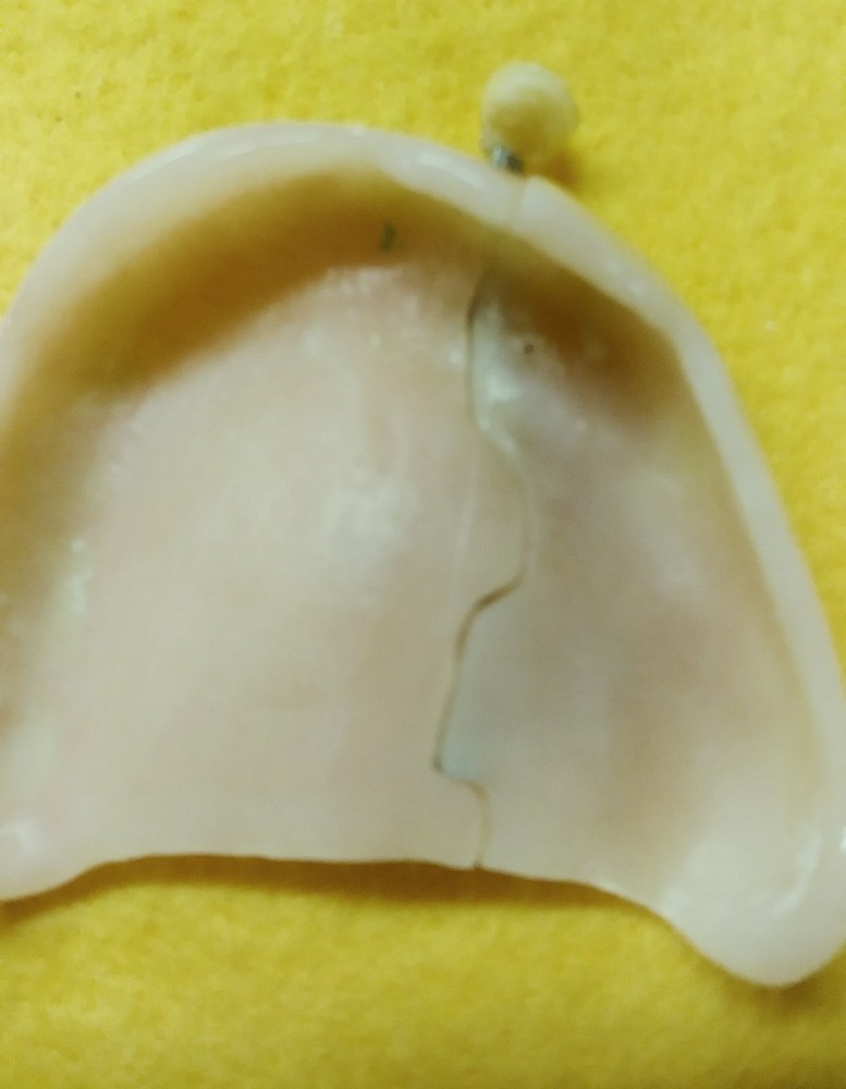 Devided Denture DENTAL DEMONSTRATION TEACHING MODEL Lab Dentist & Oral Surgeon