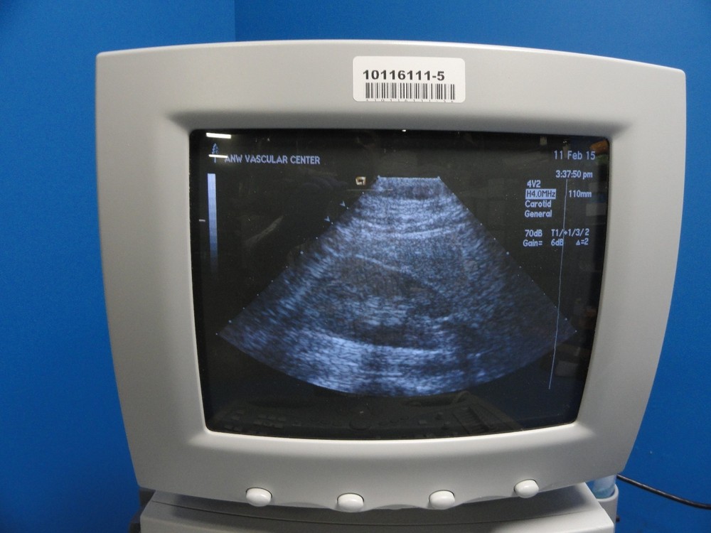 Siemens Acuson 4V2 Vector Array Ultrasound Transducer/Probe W/ Case ~ 8592