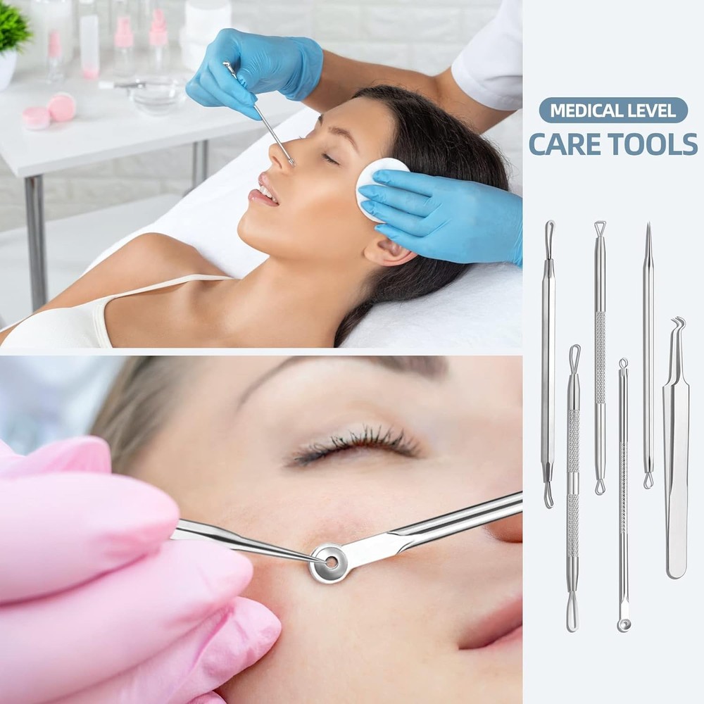 Blackhead Remover Comedone Extractor Acne Removal Kit