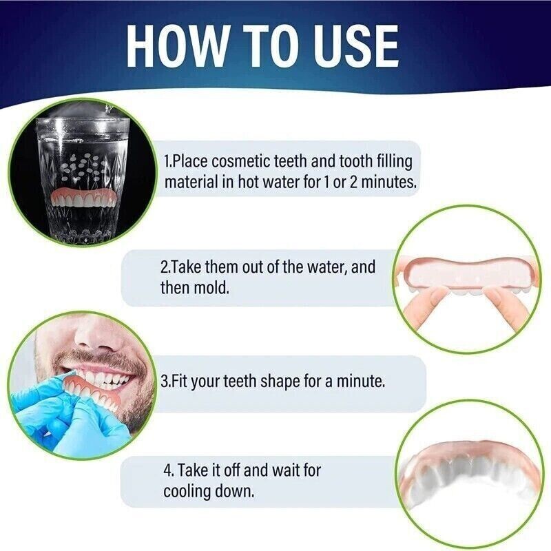Instant Smile Natural Shade Complete Teeth Makeover Kit, Upper & Lower Veneers