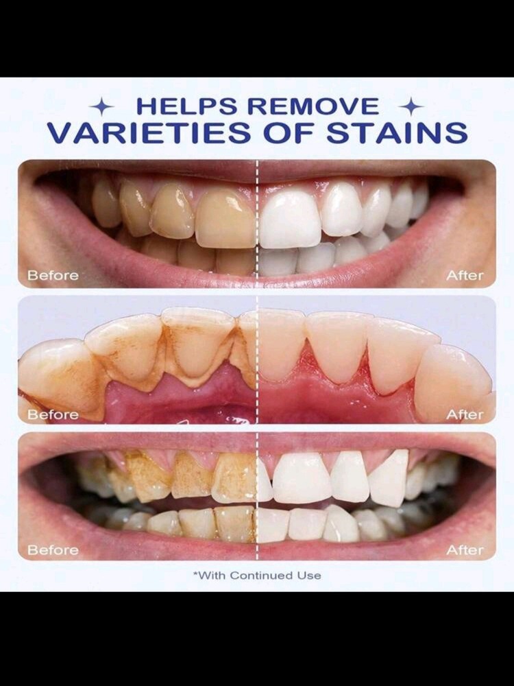 Teeth Whitening Powder