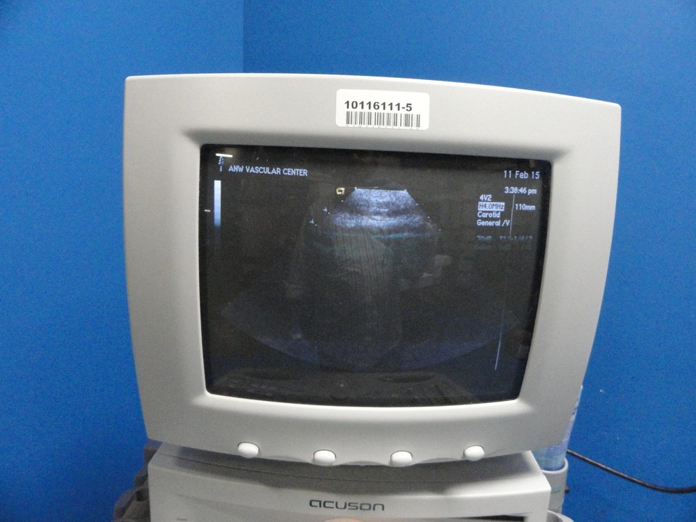 Siemens Acuson 4V2 Vector Array Ultrasound Transducer/Probe W/ Case ~ 8592