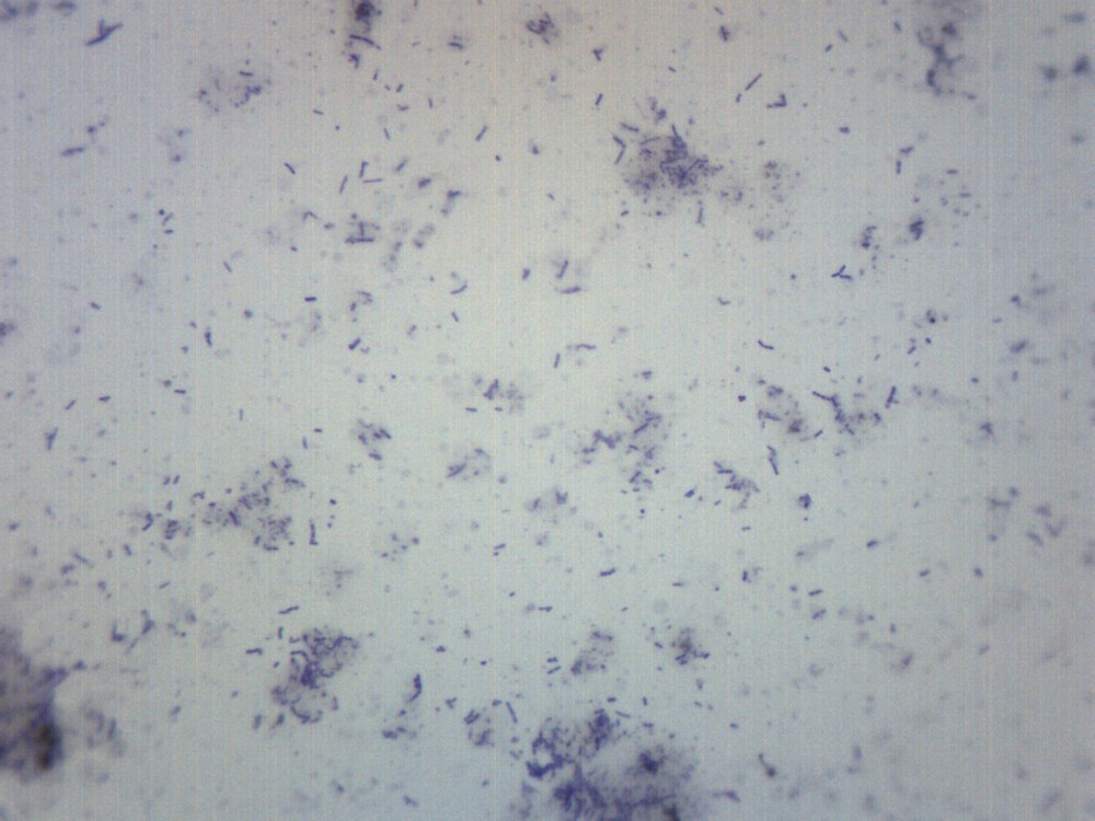 Bacteria from Mouth - Prepared Microscope Slide - 75x25mm - Eisco Labs
