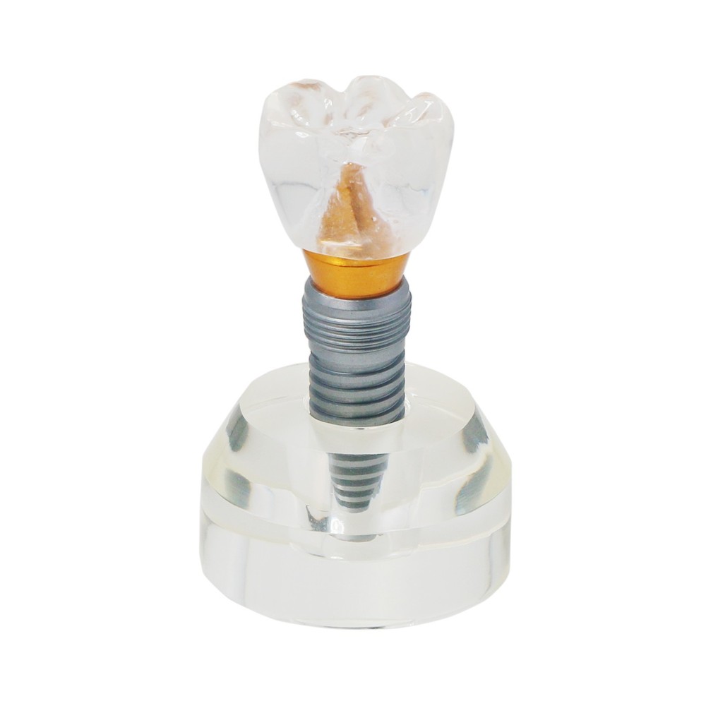 Dental Implant Teeth Model Demonstration Study Teach Model Clear M2020
