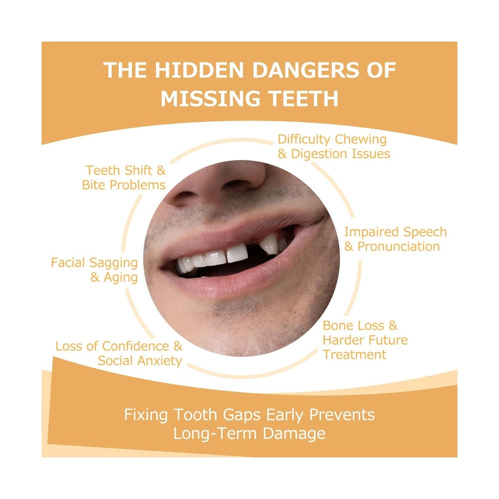 Partial Dentures - Dentures for Missing Teeth & Gaps - Lightweight & Unbreaka...