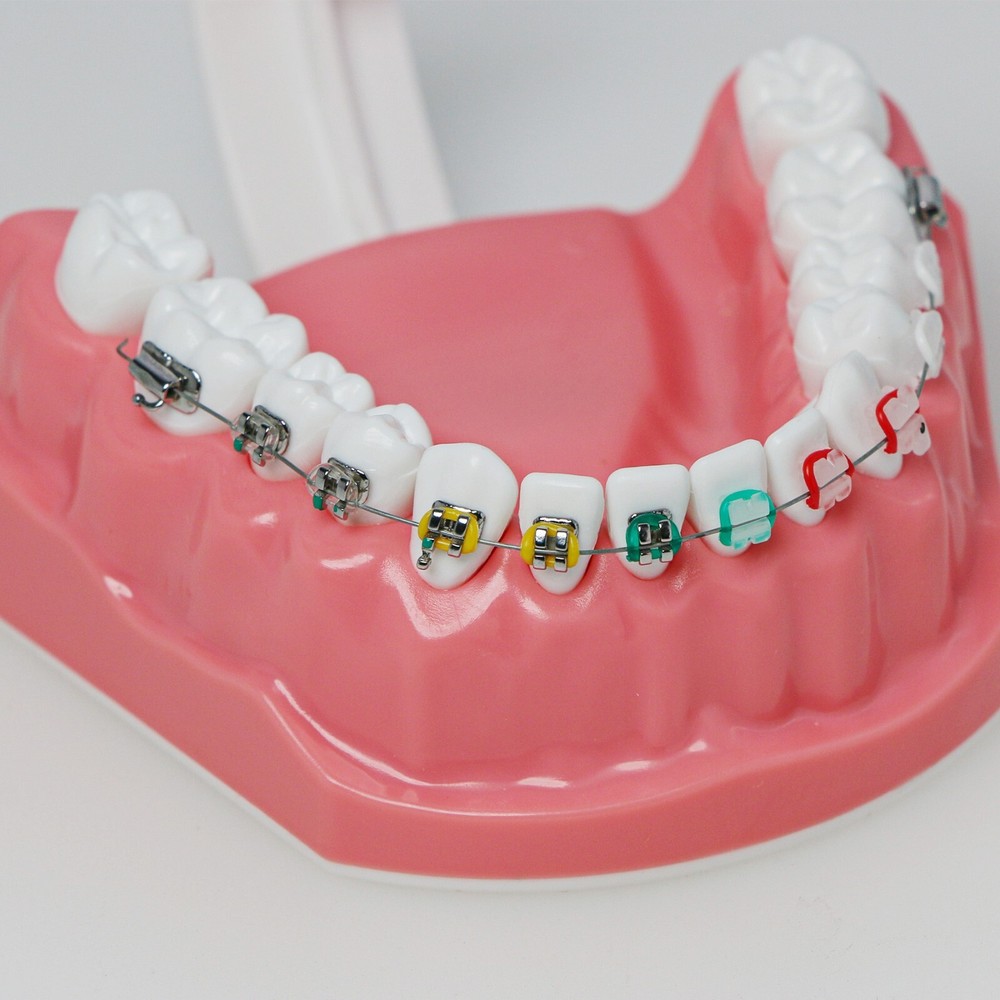 Dental 1:1 Teach Study Typodont Teeth Model Half Metal Ceramic Brackets Tubes