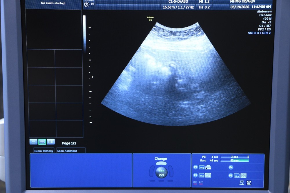 GE C1-5-D Convex Array Ultrasound Transducer