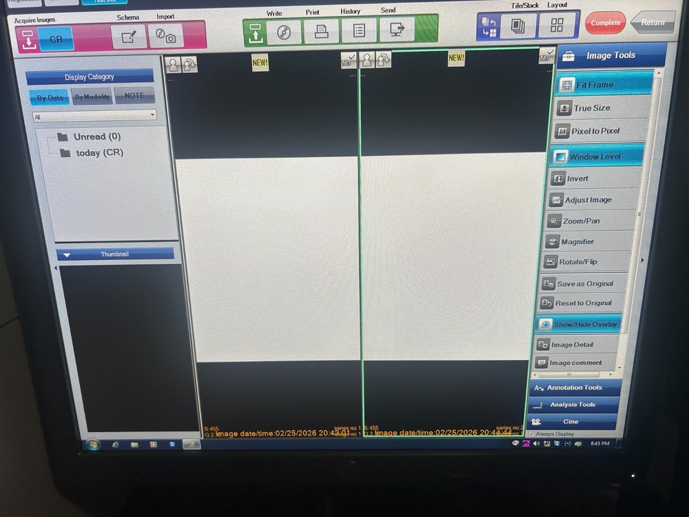 Konica Sigma CR Imaging System with Workstation & Cassettes