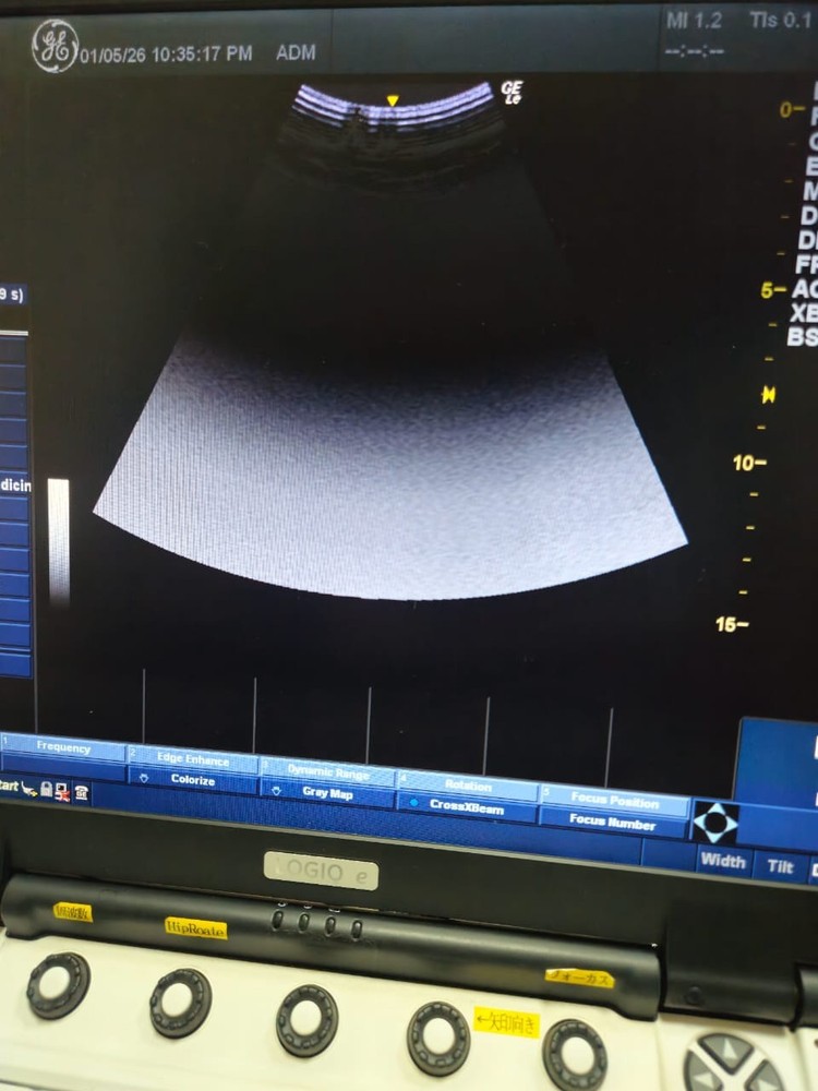 GE 4C-RS Convex Transducer with Shadow