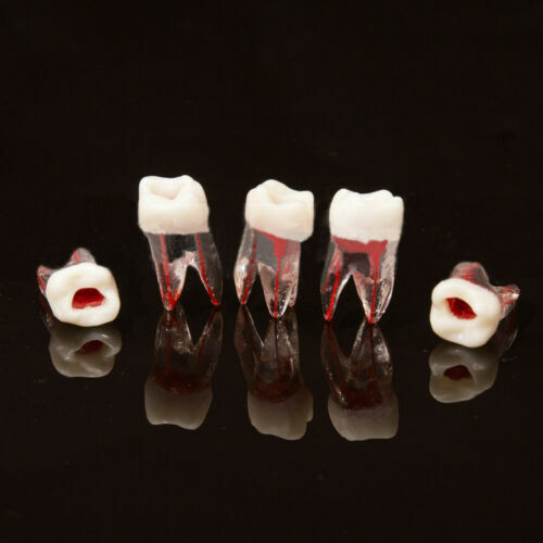 Dental Tooth Endo Root Canal Study Model RCT Practice Block Pulp Cavity
