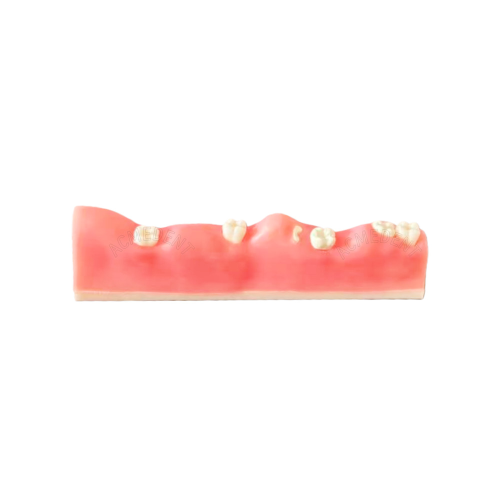 Dental Impacted Tooth Extraction Practice Model Training Gingiva Sutures Test