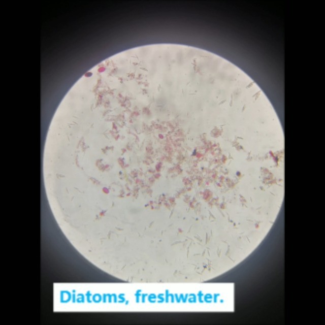 Prepared Microscope Slides Set for Biology - 16 Specimens for Science Education