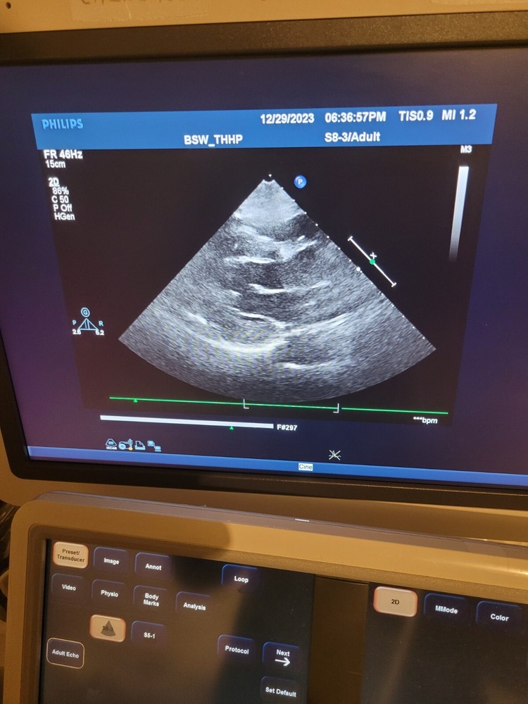 Philips S8-3 Ultrasound Ultrasound probe