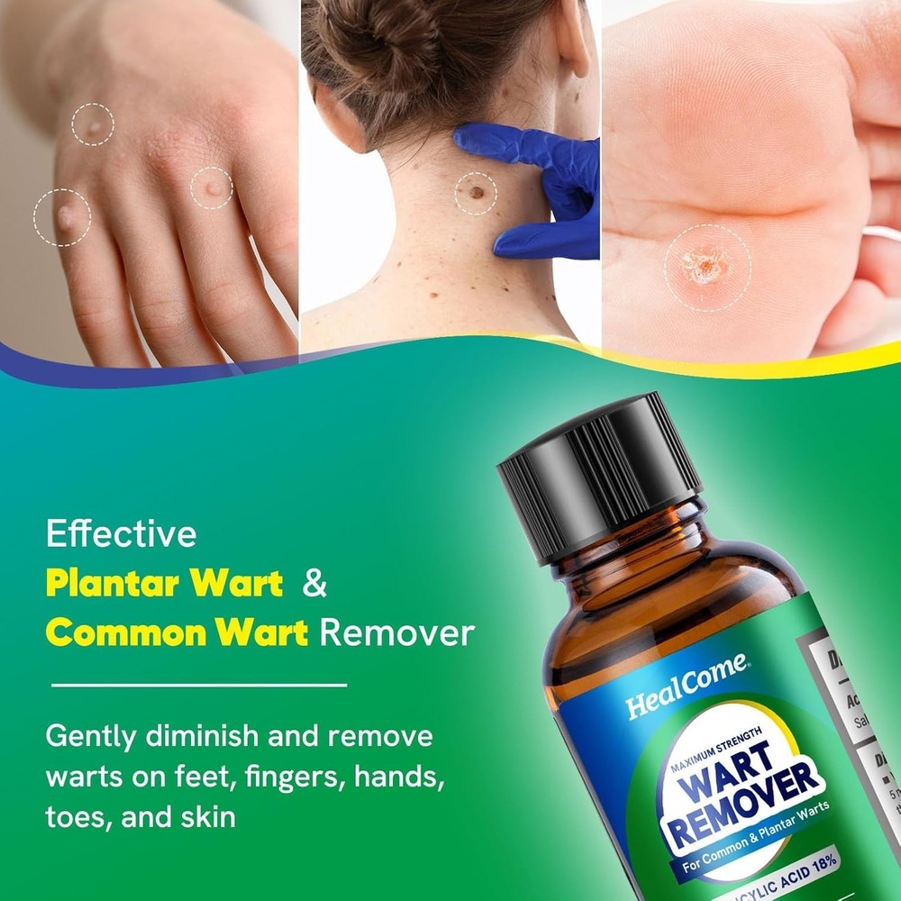 Wart Remover Fast Acting: Maximum Strength Wart Remover - Effective and Painless
