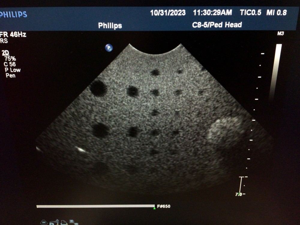 Philips C8-5 for iU22/IE33 Micro-Convex Array Ultrasound Probe