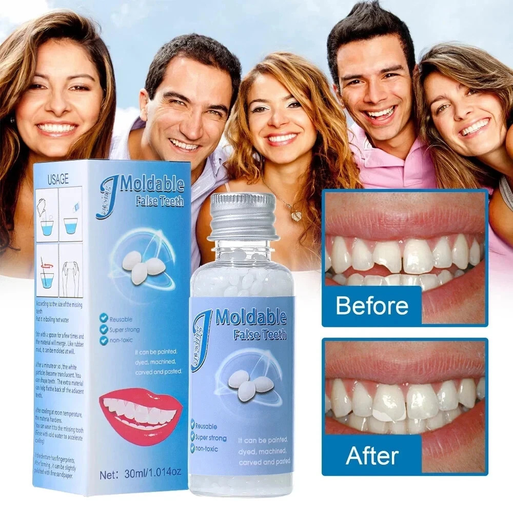 2Pcs Teeth Repair Kit, Temporary False Teeth Moldable False Teeth for Snap on