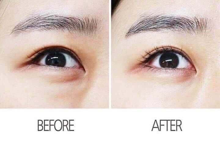 AHC 13th Generation Eye Cream 12ml
