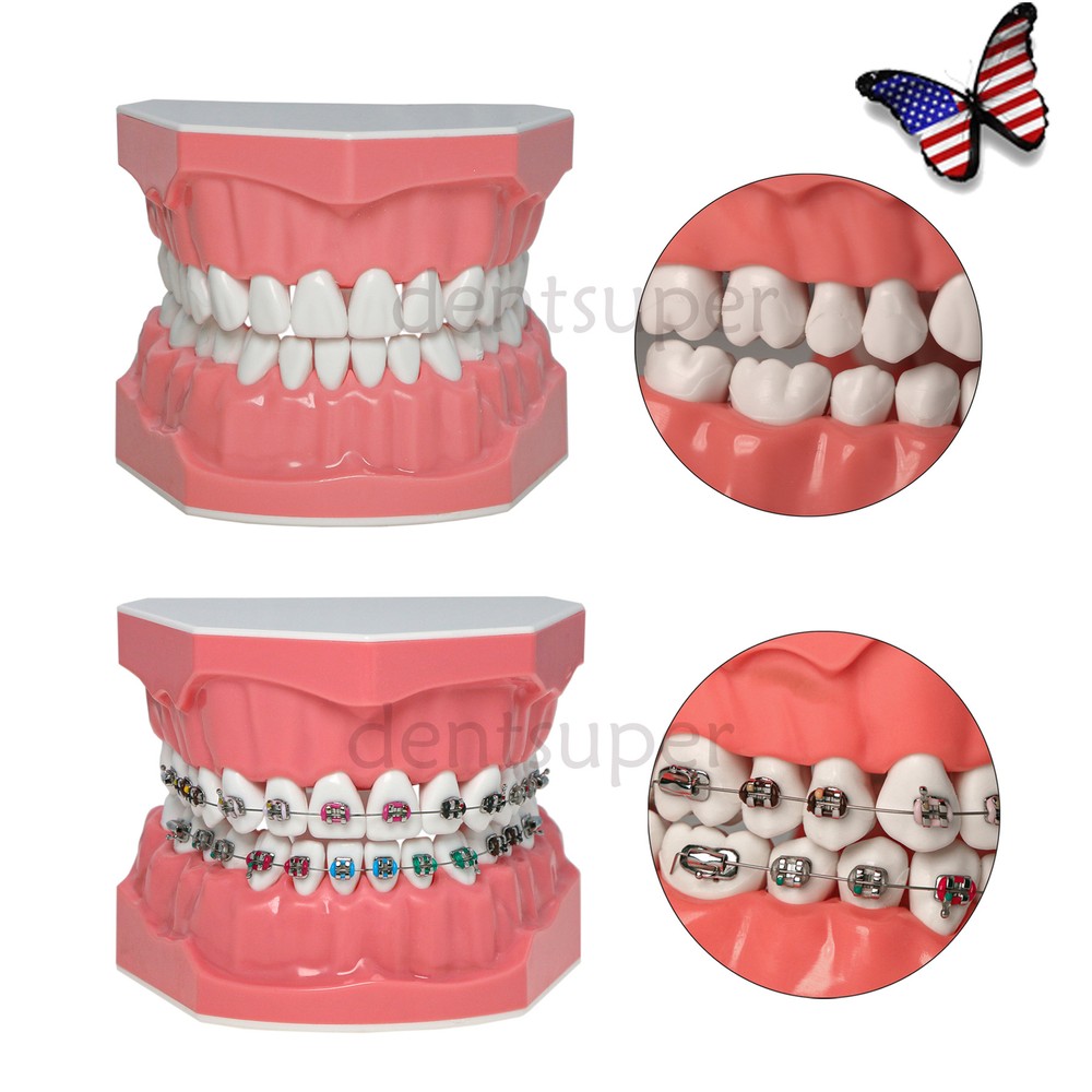 1:1 Dental Teach Study Typodont Teeth Model With Metal Ceramic Brackets Tubes