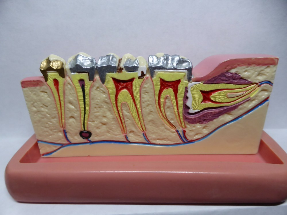 Typodont, Common Dental Pathologies Model, Patient instruction, x- section