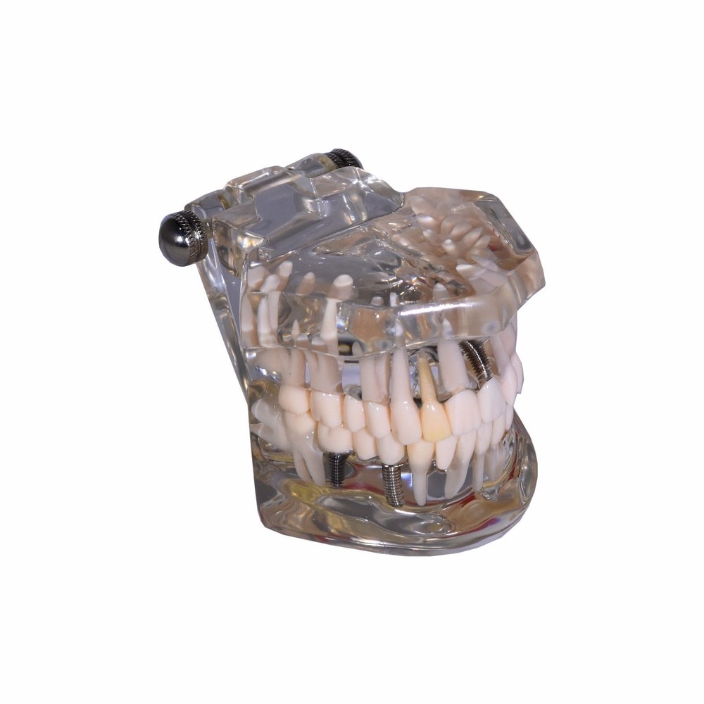 Redland Dental Demonstration Teeth Educational Model And Sales -