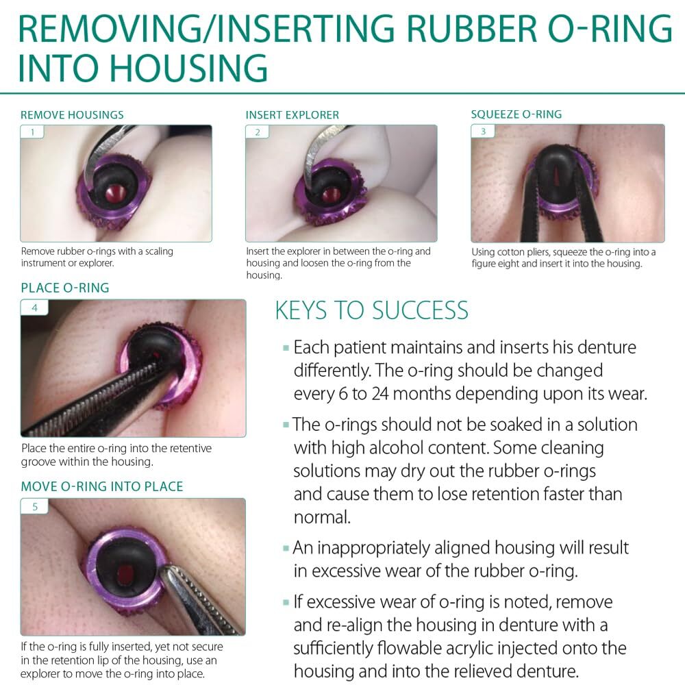 MDLMOR10Z MDLORZ Replacement O Ring Kit, for Intralock Mini Implant Black