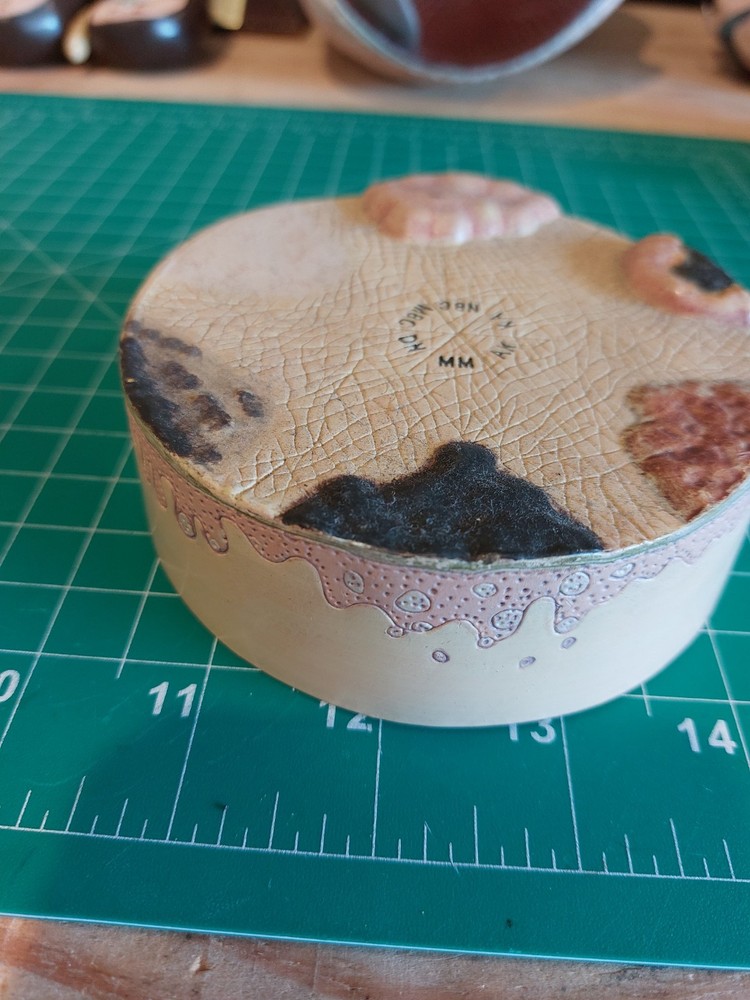 Skin Cancer Lesion Model