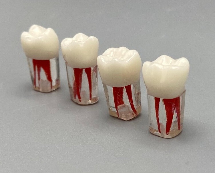 5pcs Dental Root Canal Teeth Study Practice Model Endodontic RCT Endo Pulp File
