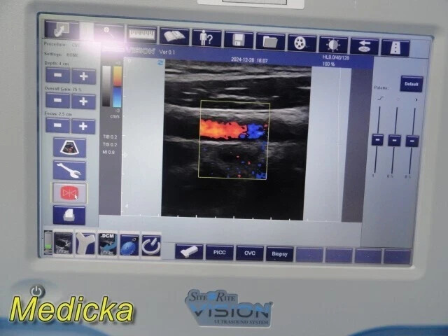 Ultrasound Imaging Probe – Linear Type | Model 128WB (Ref 9770033) ~ 36620