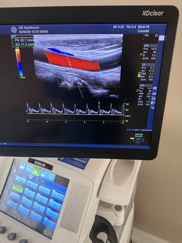 GE  ML6-15 D  Linear Vascular Probe , Excellent working condition,