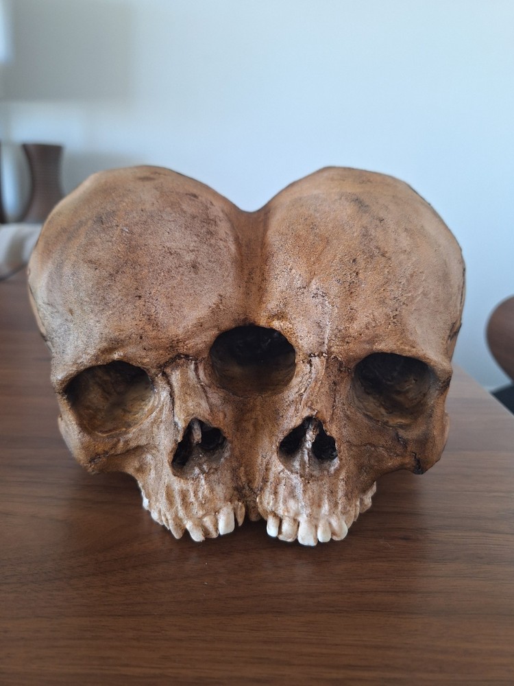 Siamese Twin Skull (Resin)