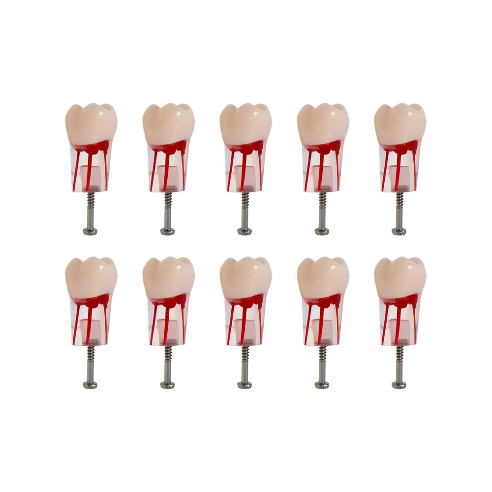 26# (UL6 First Molar) Training Models for Root Canal Procedures Dental Endo Root