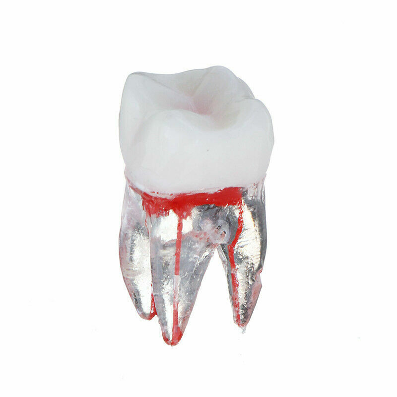 5Pcs Dental Tooth Endo Root Canal Study Model For RCT Practice Block Pulp Cavity