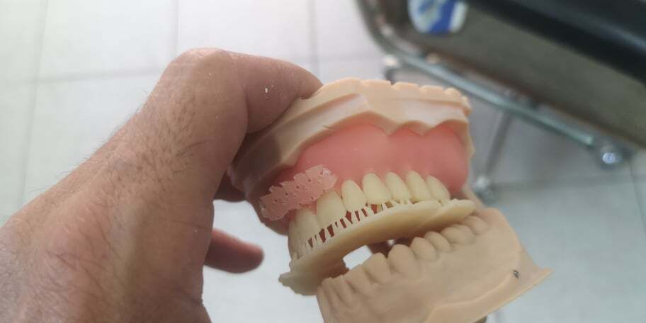 DLP SLA LCD 3d printer denture base resin for manufacturing dentures