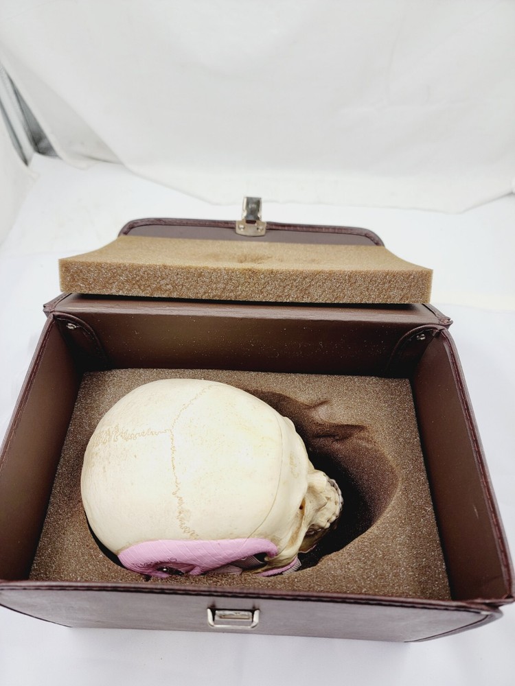 Vintage Somso Anatomical Human Skull And Case