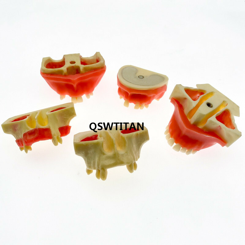 Dental Sinus Lift Practice Teeth / Tooth Model Simulation Typodont Study Model