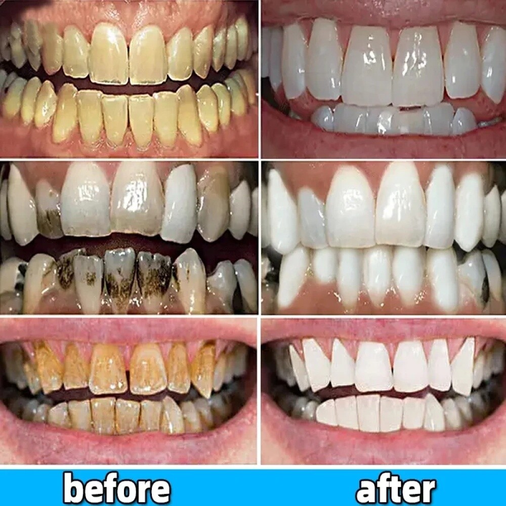 Sp-6 Probiotic Whitening Toothpaste Brightening & Bad Breath Removing Toothpaste
