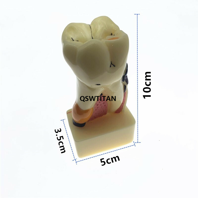 Teeth Model 4 times tooth pathology model Periodontal Teaching Study model