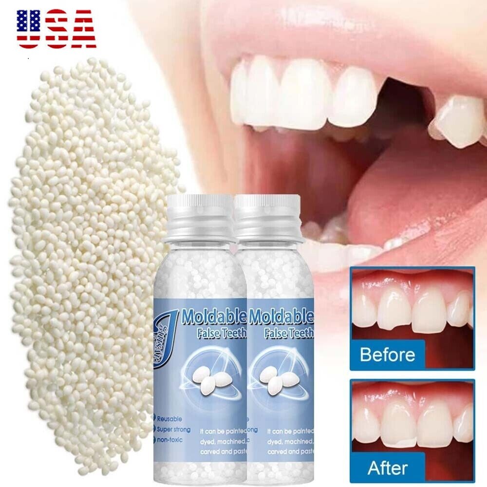 Resin False Teeth Solid Glue Temporary Tooth Repair Set Teeth And Gap Adhesive