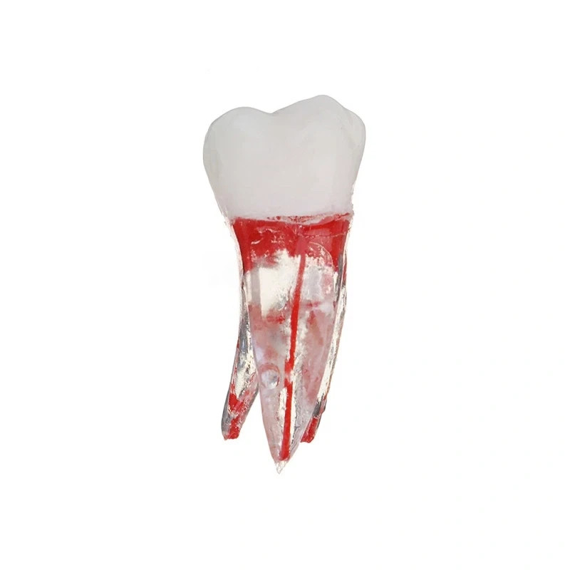 5Pcs Dental Tooth Endo Root Canal Study Model For RCT Practice Block Pulp Cavity