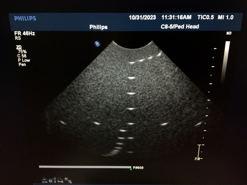 Philips C8-5 for iU22/IE33 Micro-Convex Array Ultrasound Probe