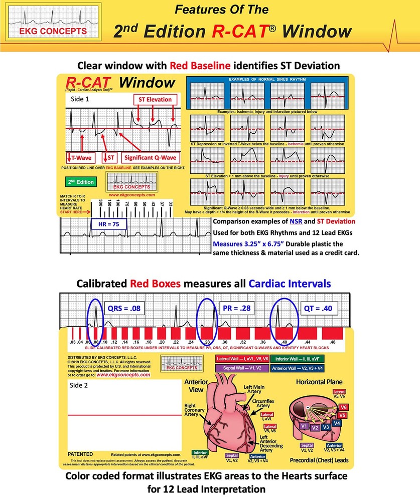 EKG Window 2nd Edition