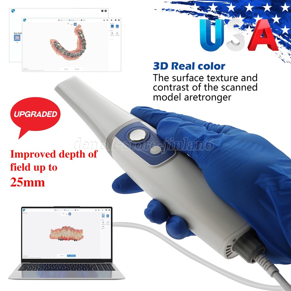 V5 Intraoral Scanner - Compact, Fast, and Efficient for Digital Dentistry
