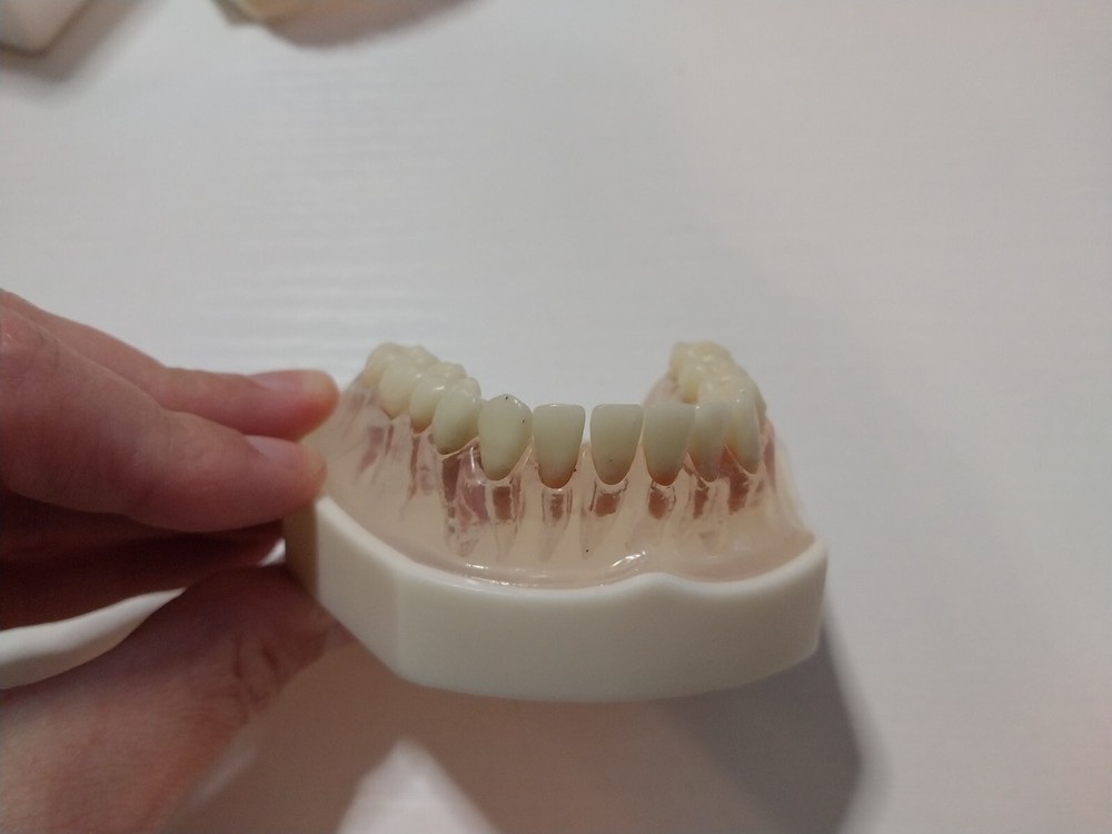 Dental Study Model Acadental