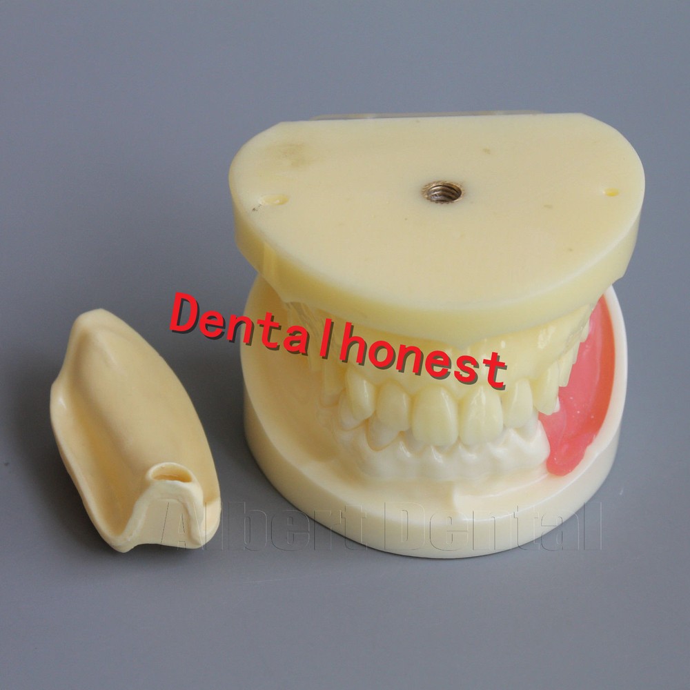 Great Dental Full Planting Drilling Practice Teeth Study Model Typodont Model